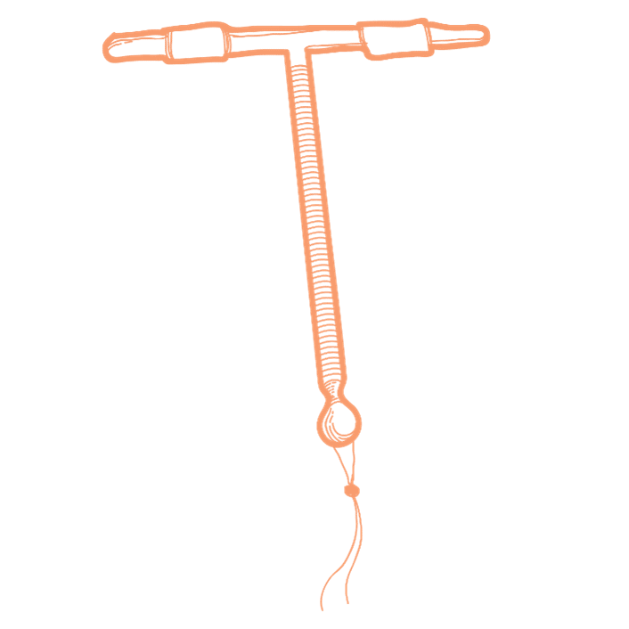 wallace miller- paragard IUD lawsuit